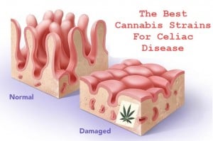 cannabisceliacdisease